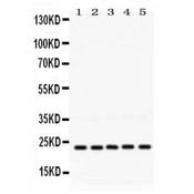 RAB18 Antibody - Rab18 antibody Western blot. All lanes: Anti Rab18 at 0.5 ug/ml. Lane 1: Rat Testis Tissue Lysate at 50 ug. Lane 2: Rat Lung Tissue Lysate at 50 ug. Lane 3: 293T Whole Cell Lysate at 40 ug. Lane 4: HELA Whole Cell Lysate at 40 ug. Lane 5: HEPG2 Whole Cell Lysate at 40 ug. Predicted band size: 23 kD. Observed band size: 23 kD.