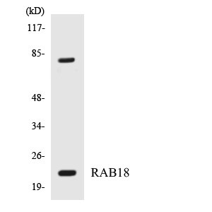 RAB18 Antibody - Western blot analysis of the lysates from HepG2 cells using RAB18 antibody.