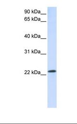 RAB18 Antibody - Hela cell lysate. Antibody concentration: 1.0 ug/ml. Gel concentration: 12%.  This image was taken for the unconjugated form of this product. Other forms have not been tested.