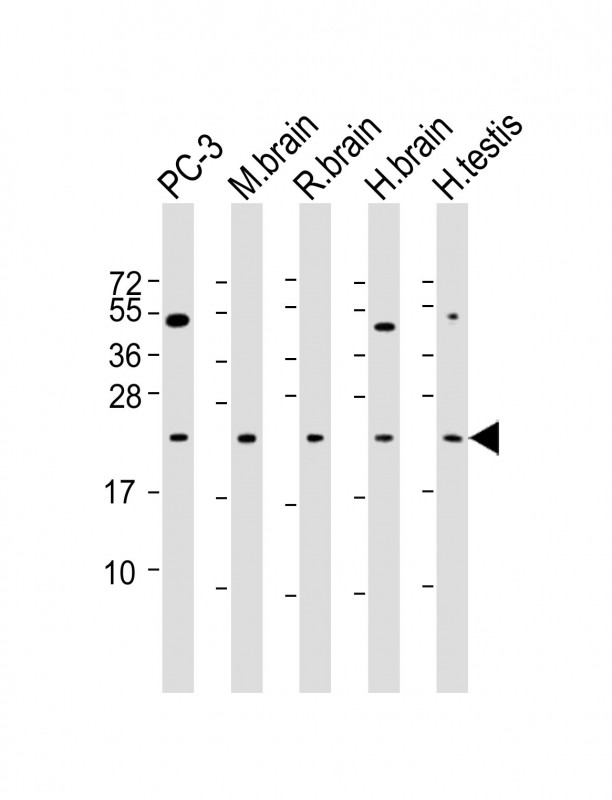 RAB18 Antibody - All lanes: Anti-RAB18 Antibody at 1:500-1:2000 dilution. Lane 1: PC-3 whole cell lysate. Lane 2: mouse brain lysate. Lane 3: rat brain lysate. Lane 4: human brain lysate. Lane 5: human testis lysate Lysates/proteins at 20 ug per lane. Secondary Goat Anti-mouse IgG, (H+L), Peroxidase conjugated at 1:10000 dilution. Predicted band size: 23 kDa. Blocking/Dilution buffer: 5% NFDM/TBST.