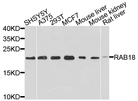 RAB18 Antibody - Western blot analysis of extracts of various cells.