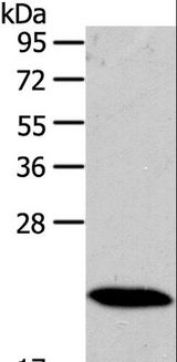RAB18 Antibody - Western blot analysis of Mouse heart tissue, using RAB18 Polyclonal Antibody at dilution of 1:400.