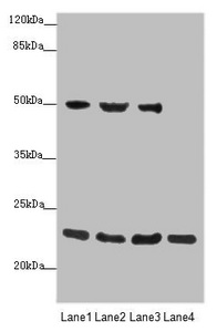 RAB18 Antibody - Western blot All Lanes: RAB18 antibody at 0.88 ug/ml Lane 1: HepG-2 whole cell lysate Lane 2: PC-3 whole cell lysate Lane 3: A375 whole cell lysate Lane 4: 293T whole cell lysate Secondary Goat polyclonal to rabbit IgG at 1/10000 dilution Predicted band size: 23,27,16 kDa Observed band size: 23,50 kDa
