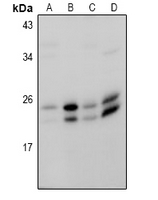 RAB18 Antibody - Western blot analysis of RAB18 expression in A549 (A), Hela (B), BV2 (C), C6 (D) whole cell lysates.