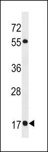 RAB19 Antibody - RAB19 Antibody western blot of SK-BR-3 cell line lysates (35 ug/lane). The RAB19 antibody detected the RAB19 protein (arrow).