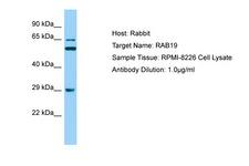 RAB19 Antibody -  This image was taken for the unconjugated form of this product. Other forms have not been tested.