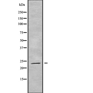 RAB19 Antibody - Western blot analysis of RAB19 using HT29 whole cells lysates