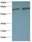 RAB1A Antibody - Western blot of Ras-related protein Rab-1A antibody at 2 ug/ml. Lane 1: EC109 whole cell lysate. Lane 2: 293T whole cell lysate. Secondary: Goat polyclonal to Rabbit IgG at 1:15000 dilution. Predicted band size: 22.5 kDa. Observed band size: 80 kDa.  This image was taken for the unconjugated form of this product. Other forms have not been tested.