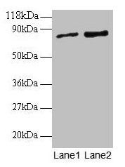 RAB1A Antibody - Western blot All lanes: Ras-related protein Rab-1A antibody at 2µg/ml Lane 1: EC109 whole cell lysate Lane 2: 293T whole cell lysate Secondary Goat polyclonal to rabbit IgG at 1/15000 dilution Predicted band size: 23, 16, 14 kDa Observed band size: 80 kDa