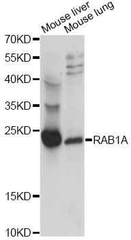 RAB1A Antibody - Western blot analysis of extracts of various cell lines, using RAB1A antibody at 1:1000 dilution. The secondary antibody used was an HRP Goat Anti-Rabbit IgG (H+L) at 1:10000 dilution. Lysates were loaded 25ug per lane and 3% nonfat dry milk in TBST was used for blocking. An ECL Kit was used for detection and the exposure time was 5s.