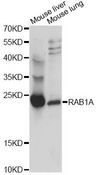 RAB1A Antibody - Western blot analysis of extracts of various cell lines, using RAB1A antibody at 1:1000 dilution. The secondary antibody used was an HRP Goat Anti-Rabbit IgG (H+L) at 1:10000 dilution. Lysates were loaded 25ug per lane and 3% nonfat dry milk in TBST was used for blocking. An ECL Kit was used for detection and the exposure time was 5s.