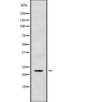 RAB1A Antibody - Western blot analysis of RAB1A using HT29 whole cells lysates