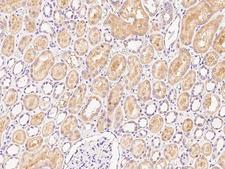 RAB1A Antibody - Immunochemical staining of human RAB1A in human kidney with rabbit polyclonal antibody at 1:200 dilution, formalin-fixed paraffin embedded sections.
