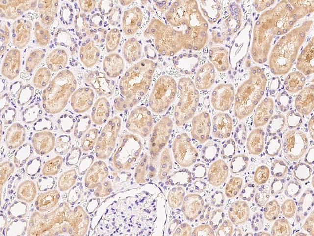 RAB1A Antibody - Immunochemical staining of human RAB1A in human kidney with rabbit polyclonal antibody at 1:200 dilution, formalin-fixed paraffin embedded sections.