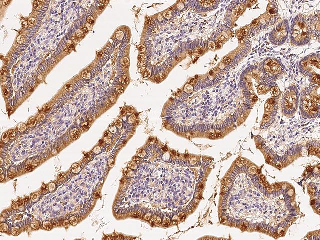 RAB1A Antibody - Immunochemical staining of human RAB1A in human small intestine with rabbit polyclonal antibody at 1:200 dilution, formalin-fixed paraffin embedded sections.