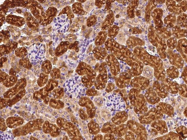 RAB1A Antibody - Immunochemical staining of human RAB1A in mouse kidney with rabbit polyclonal antibody at 1:200 dilution, formalin-fixed paraffin embedded sections.