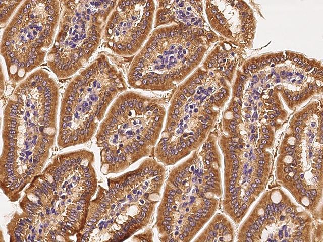 RAB1A Antibody - Immunochemical staining of human RAB1A in mouse small intestine with rabbit polyclonal antibody at 1:200 dilution, formalin-fixed paraffin embedded sections.