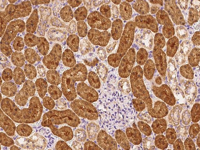 RAB1A Antibody - Immunochemical staining of human RAB1A in rat kidney with rabbit polyclonal antibody at 1:200 dilution, formalin-fixed paraffin embedded sections.