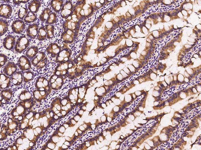 RAB1A Antibody - Immunochemical staining of human RAB1A in rat small intestine with rabbit polyclonal antibody at 1:200 dilution, formalin-fixed paraffin embedded sections.