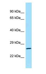 RAB1B Antibody - RAB1B antibody Western Blot using Fetal Kidney Lysate at 1ug/ml..  This image was taken for the unconjugated form of this product. Other forms have not been tested.