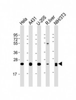 RAB1B Antibody - All lanes: Anti-RAB1B Antibody at 1:4000 dilution Lane 1: Hela whole cell lysate Lane 2: A431 whole cell lysate Lane 3: U-20S whole cell lysate Lane 4: rat liver lysate Lane 5: NIH/3T3 whole cell lysate Lysates/proteins at 20 µg per lane. Secondary Goat Anti-mouse IgG, (H+L), Peroxidase conjugated at 1/10000 dilution. Predicted band size: 22 kDa Blocking/Dilution buffer: 5% NFDM/TBST.