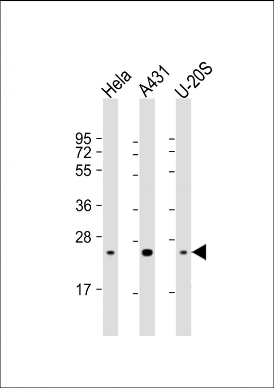 RAB1B Antibody - All lanes: Anti-RAB1B Antibody at 1:4000 dilution Lane 1: Hela whole cell lysate Lane 2: A431 whole cell lysate Lane 3: U-20S whole cell lysate Lysates/proteins at 20 µg per lane. Secondary Goat Anti-mouse IgG, (H+L), Peroxidase conjugated at 1/10000 dilution. Predicted band size: 22 kDa Blocking/Dilution buffer: 5% NFDM/TBST.