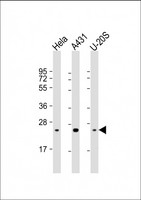 RAB1B Antibody - All lanes: Anti-RAB1B Antibody at 1:4000 dilution Lane 1: Hela whole cell lysate Lane 2: A431 whole cell lysate Lane 3: U-20S whole cell lysate Lysates/proteins at 20 µg per lane. Secondary Goat Anti-mouse IgG, (H+L), Peroxidase conjugated at 1/10000 dilution. Predicted band size: 22 kDa Blocking/Dilution buffer: 5% NFDM/TBST.