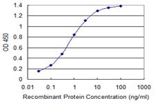 RAB1B Antibody - Detection limit for recombinant GST tagged RAB1B is 0.03 ng/ml as a capture antibody.
