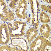 RAB1B Antibody - Immunohistochemistry of paraffin-embedded human kidney tissue.
