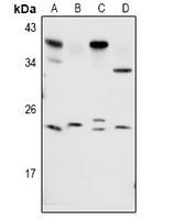 RAB1B Antibody - Western blot analysis of RAB1B expression in BV2 (A), C6 (B), A549 (C), Hela (D) whole cell lysates.