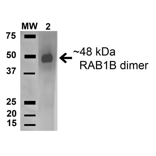 RAB1B Antibody - Western blot analysis of Rat Pancreas showing detection of 22.1 kDa RAB1B protein using Rabbit Anti-RAB1B Polyclonal Antibody. Lane 1: Molecular Weight Ladder (MW). Lane 2: Rat Pancreas cell lysates. Load: 15 µg. Block: 5% Skim Milk in 1X TBST. Primary Antibody: Rabbit Anti-RAB1B Polyclonal Antibody  at 1:1000 for 1 hour at RT. Secondary Antibody: Goat Anti-Rabbit HRP at 1:2000 for 60 min at RT. Color Development: ECL solution for 6 min in RT. Predicted/Observed Size: 22.1 kDa.