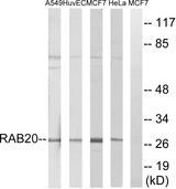 RAB20 Antibody - Western blot analysis of lysates from HeLa, MCF-7, HUVEC, and A549 cells, using RAB20 Antibody. The lane on the right is blocked with the synthesized peptide.