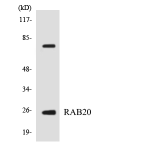 RAB20 Antibody - Western blot analysis of the lysates from HeLa cells using RAB20 antibody.