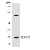 RAB20 Antibody - Western blot analysis of the lysates from HeLa cells using RAB20 antibody.
