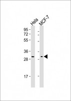 RAB20 Antibody - All lanes: Anti-RAB20 Antibody at 1:2000-1:4000 dilution Lane 1: Hela whole cell lysate Lane 2: MCF-7 whole cell lysate Lysates/proteins at 20 µg per lane. Secondary Goat Anti-Mouse IgG, (H+L), Peroxidase conjugated at 1/10000 dilution. Predicted band size: 26 kDa Blocking/Dilution buffer: 5% NFDM/TBST.