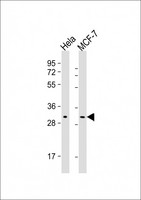 RAB20 Antibody - All lanes: Anti-RAB20 Antibody at 1:2000-1:4000 dilution Lane 1: Hela whole cell lysate Lane 2: MCF-7 whole cell lysate Lysates/proteins at 20 µg per lane. Secondary Goat Anti-Mouse IgG, (H+L), Peroxidase conjugated at 1/10000 dilution. Predicted band size: 26 kDa Blocking/Dilution buffer: 5% NFDM/TBST.
