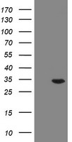 RAB20 Antibody - HEK293T cells were transfected with the pCMV6-ENTRY control (Left lane) or pCMV6-ENTRY RAB20 (Right lane) cDNA for 48 hrs and lysed. Equivalent amounts of cell lysates (5 ug per lane) were separated by SDS-PAGE and immunoblotted with anti-RAB20.