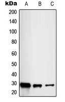 RAB20 Antibody - Western blot analysis of RAB20 expression in HL60 (A); HeLa (B); HUVEC (C) whole cell lysates.