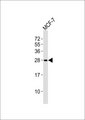 RAB20 Antibody - Anti-RAB20 Antibody at 1:1000 dilution + MCF-7 whole cell lysates Lysates/proteins at 20 ug per lane. Secondary Goat Anti-Rabbit IgG, (H+L),Peroxidase conjugated at 1/10000 dilution Predicted band size : 26 kDa Blocking/Dilution buffer: 5% NFDM/TBST.