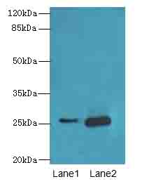 RAB20 Antibody - Western blot. All lanes: RAB20 antibody at 0.6 ug/ml. Lane 1: HL60 whole cell lysate. Lane 2: U937 whole cell lysate. Secondary Goat polyclonal to Rabbit IgG at 1:10000 dilution. Predicted band size: 26 kDa. Observed band size: 26 kDa.