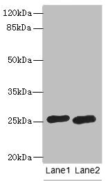 RAB20 Antibody - Western blot All lanes: RAB20 antibody at 0.6µg/ml Lane 1: HL60 whole cell lysate Lane 2: U937 whole cell lysate Secondary Goat polyclonal to rabbit IgG at 1/10000 dilution Predicted band size: 26 kDa Observed band size: 26 kDa