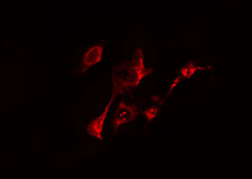 RAB20 Antibody - Staining HeLa cells by IF/ICC. The samples were fixed with PFA and permeabilized in 0.1% Triton X-100, then blocked in 10% serum for 45 min at 25°C. The primary antibody was diluted at 1:200 and incubated with the sample for 1 hour at 37°C. An Alexa Fluor 594 conjugated goat anti-rabbit IgG (H+L) antibody, diluted at 1/600, was used as secondary antibody.