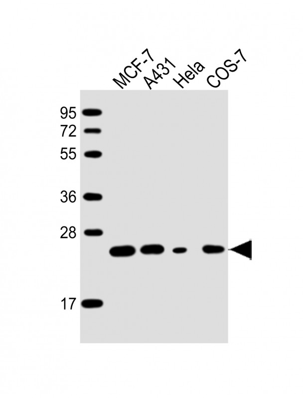 RAB21 Antibody - All lanes: Anti-RAB21 Antibody at 1:2000 dilution Lane 1: MCF-7 whole cell lysate Lane 2: A431 whole cell lysate Lane 3: Hela whole cell lysate Lane 4: COS-7 whole cell lysate Lysates/proteins at 20 µg per lane. Secondary Goat Anti-mouse IgG, (H+L), Peroxidase conjugated at 1/10000 dilution. Predicted band size: 24 kDa Blocking/Dilution buffer: 5% NFDM/TBST.