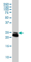 RAB21 Antibody - RAB21 monoclonal antibody (M01), clone 1F6 Western blot of RAB21 expression in HeLa.