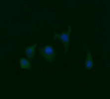 RAB21 Antibody - Immunofluorescent staining of HeLa cells using anti-RAB21 mouse monoclonal antibody.