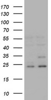 RAB21 Antibody - HEK293T cells were transfected with the pCMV6-ENTRY control (Left lane) or pCMV6-ENTRY RAB21 (Right lane) cDNA for 48 hrs and lysed. Equivalent amounts of cell lysates (5 ug per lane) were separated by SDS-PAGE and immunoblotted with anti-RAB21.