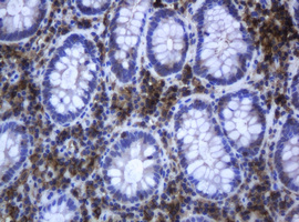 RAB21 Antibody - IHC of paraffin-embedded Human colon tissue using anti-RAB21 mouse monoclonal antibody.