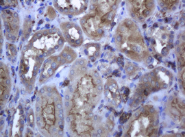 RAB21 Antibody - IHC of paraffin-embedded Human Kidney tissue using anti-RAB21 mouse monoclonal antibody.