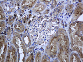 RAB21 Antibody - IHC of paraffin-embedded Human Kidney tissue using anti-RAB21 mouse monoclonal antibody.