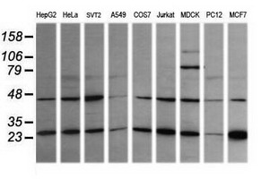RAB21 Antibody - Western blot of extracts (35 ug) from 9 different cell lines by using g anti-RAB21 monoclonal antibody (HepG2: human; HeLa: human; SVT2: mouse; A549: human; COS7: monkey; Jurkat: human; MDCK: canine; PC12: rat; MCF7: human).